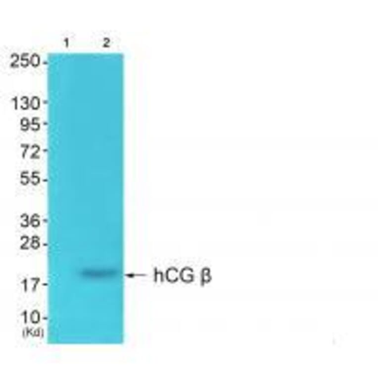 Western blot - hCG β Antibody from Signalway Antibody (33397) - Antibodies.com