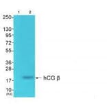 Western blot - hCG β Antibody from Signalway Antibody (33397) - Antibodies.com