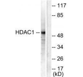 Western blot - HDAC1 Antibody from Signalway Antibody (33398) - Antibodies.com