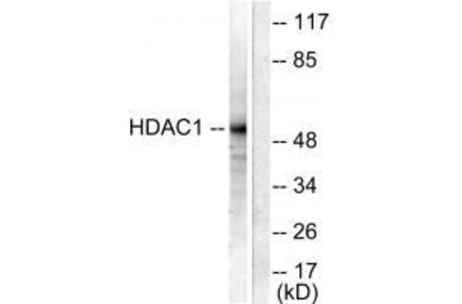 Western blot - HDAC1 Antibody from Signalway Antibody (33398) - Antibodies.com