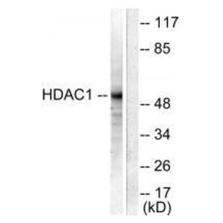 Western blot - HDAC1 Antibody from Signalway Antibody (33398) - Antibodies.com