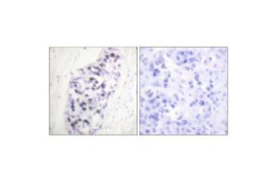 Immunohistochemistry - HDAC1 Antibody from Signalway Antibody (33398) - Antibodies.com