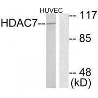Western blot analysis of extracts from HuvEc cells, using HDAC7 antibody #33402.