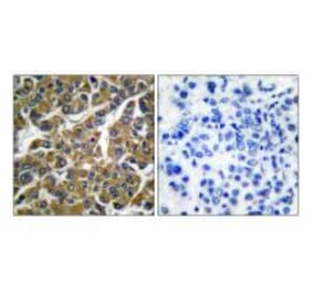 Immunohistochemistry - MMP-3 Antibody from Signalway Antibody (33443) - Antibodies.com