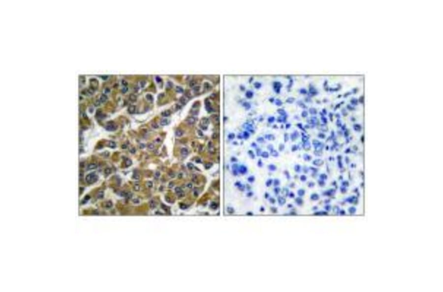 Immunohistochemistry - MMP-3 Antibody from Signalway Antibody (33443) - Antibodies.com