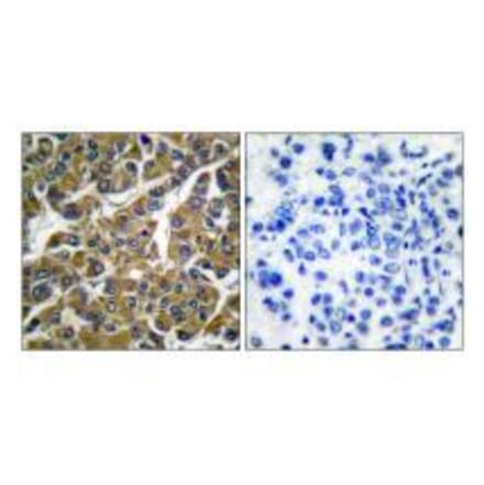 Immunohistochemistry - MMP-3 Antibody from Signalway Antibody (33443) - Antibodies.com