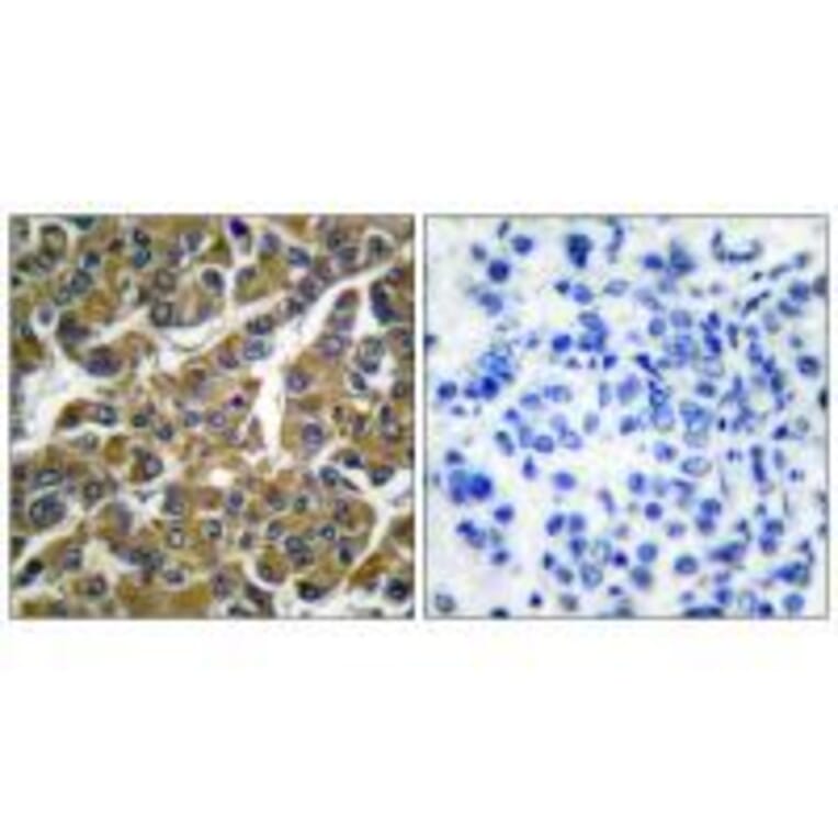 Immunohistochemistry - MMP-3 Antibody from Signalway Antibody (33443) - Antibodies.com