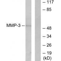 Western blot analysis of extracts from 293 cells, using MMP-3 antibody #33443.