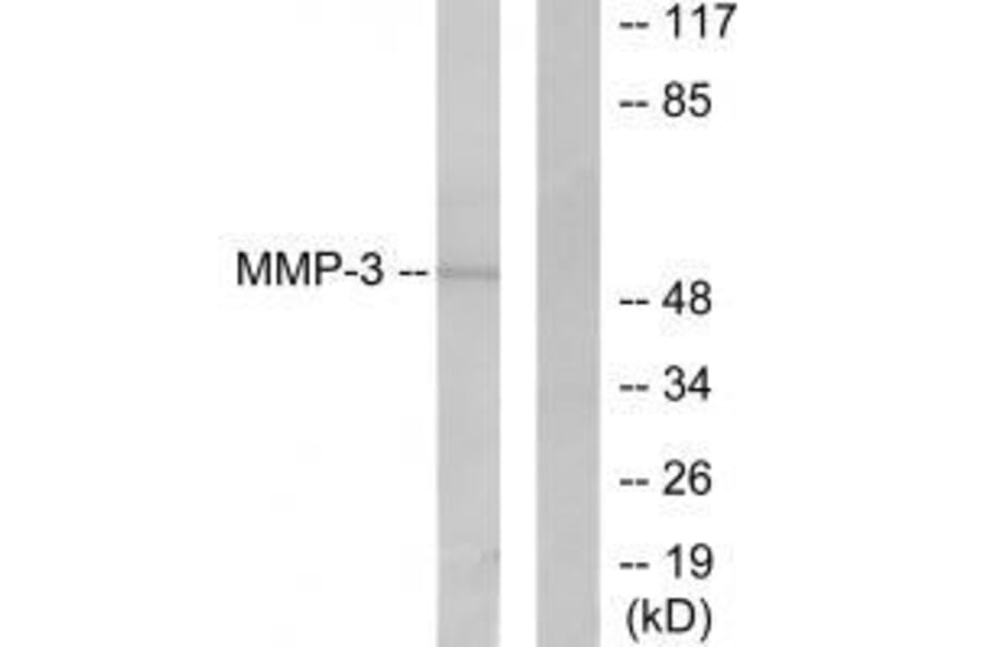 Western blot - MMP-3 Antibody from Signalway Antibody (33443) - Antibodies.com