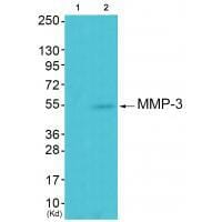 Western blot analysis of extracts from 293 cells using MMP-3 antibody #33443. The lane on the left is treated with synthesized peptide.