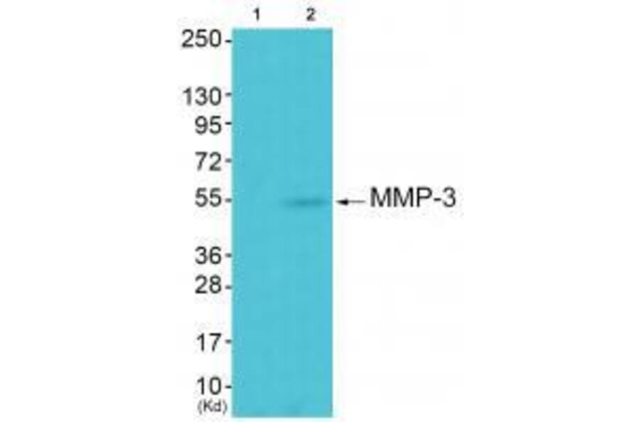 Western blot - MMP-3 Antibody from Signalway Antibody (33443) - Antibodies.com