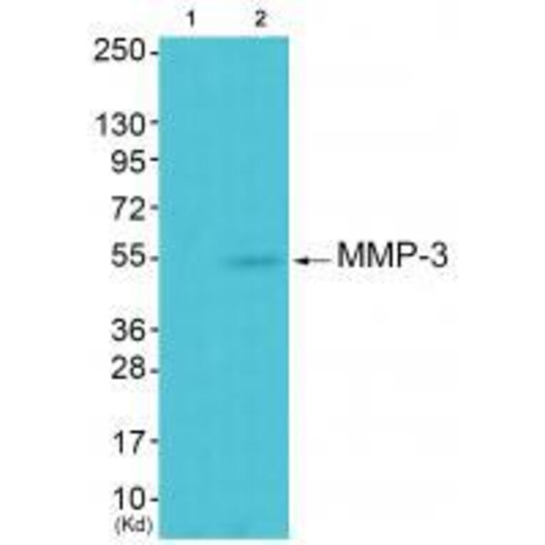 Western blot - MMP-3 Antibody from Signalway Antibody (33443) - Antibodies.com