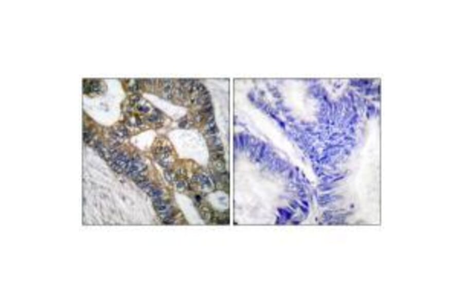 Immunohistochemistry - MMP-7 Antibody from Signalway Antibody (33444) - Antibodies.com