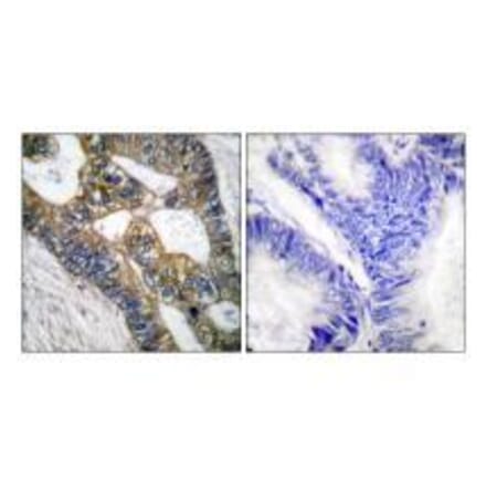 Immunohistochemistry - MMP-7 Antibody from Signalway Antibody (33444) - Antibodies.com