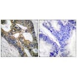 Immunohistochemistry - MMP-7 Antibody from Signalway Antibody (33444) - Antibodies.com