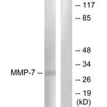 Western blot - MMP-7 Antibody from Signalway Antibody (33444) - Antibodies.com