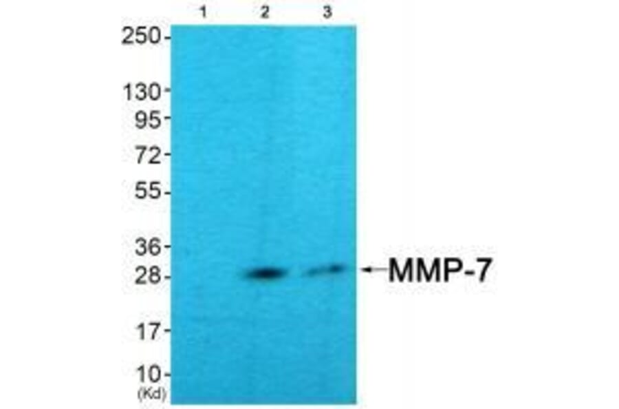 Western blot - MMP-7 Antibody from Signalway Antibody (33444) - Antibodies.com