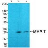 Western blot - MMP-7 Antibody from Signalway Antibody (33444) - Antibodies.com