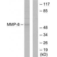 Western blot analysis of extracts from NIH/3T3 cells, using MMP-8 antibody #33445.
