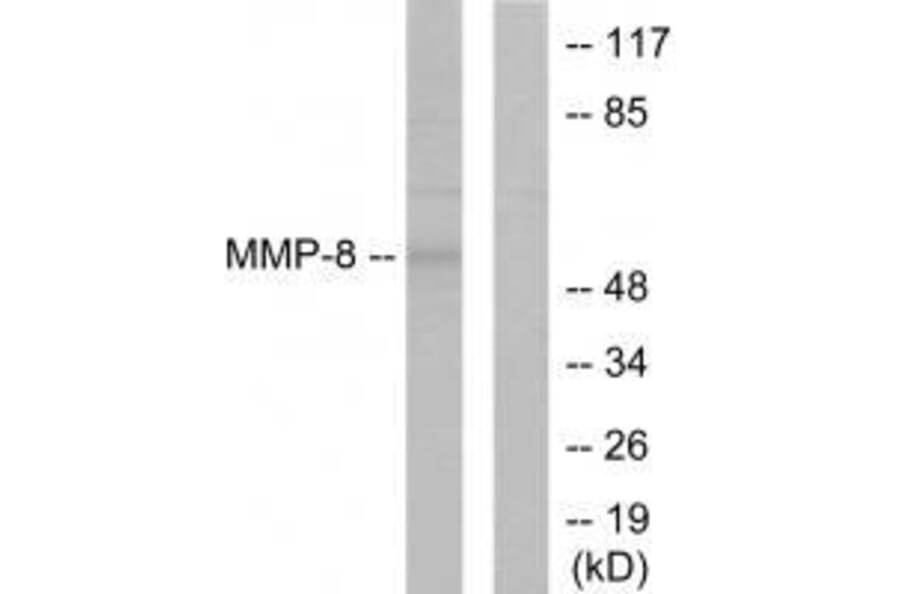 Western blot - MMP-8 Antibody from Signalway Antibody (33445) - Antibodies.com