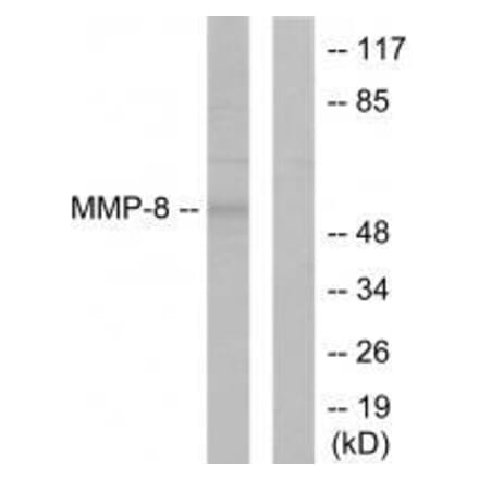 Western blot - MMP-8 Antibody from Signalway Antibody (33445) - Antibodies.com