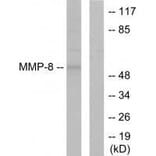 Western blot - MMP-8 Antibody from Signalway Antibody (33445) - Antibodies.com