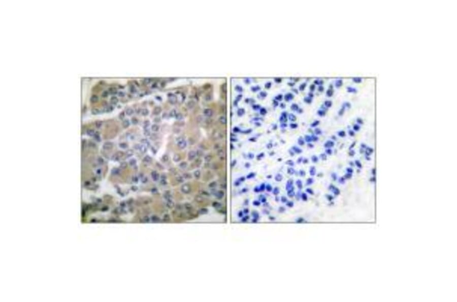 Immunohistochemistry - MMP-8 Antibody from Signalway Antibody (33445) - Antibodies.com