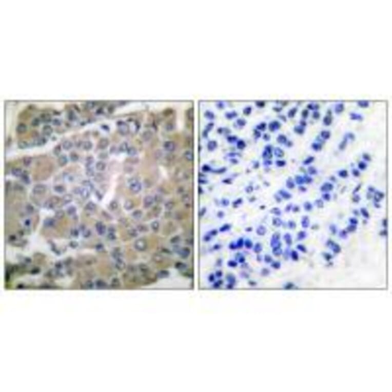 Immunohistochemistry - MMP-8 Antibody from Signalway Antibody (33445) - Antibodies.com