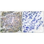 Immunohistochemistry - MMP-8 Antibody from Signalway Antibody (33445) - Antibodies.com
