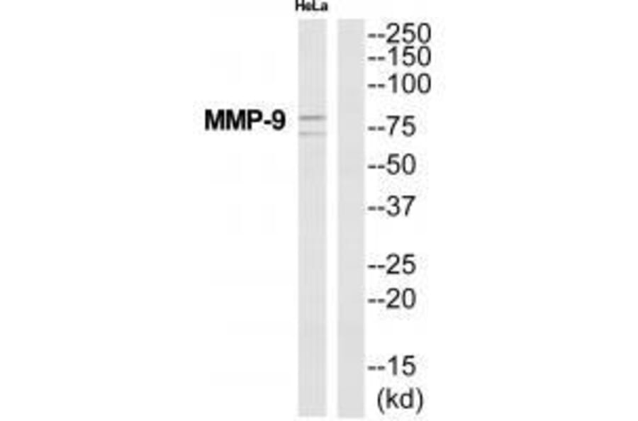 Western blot - MMP-9 Antibody from Signalway Antibody (33446) - Antibodies.com