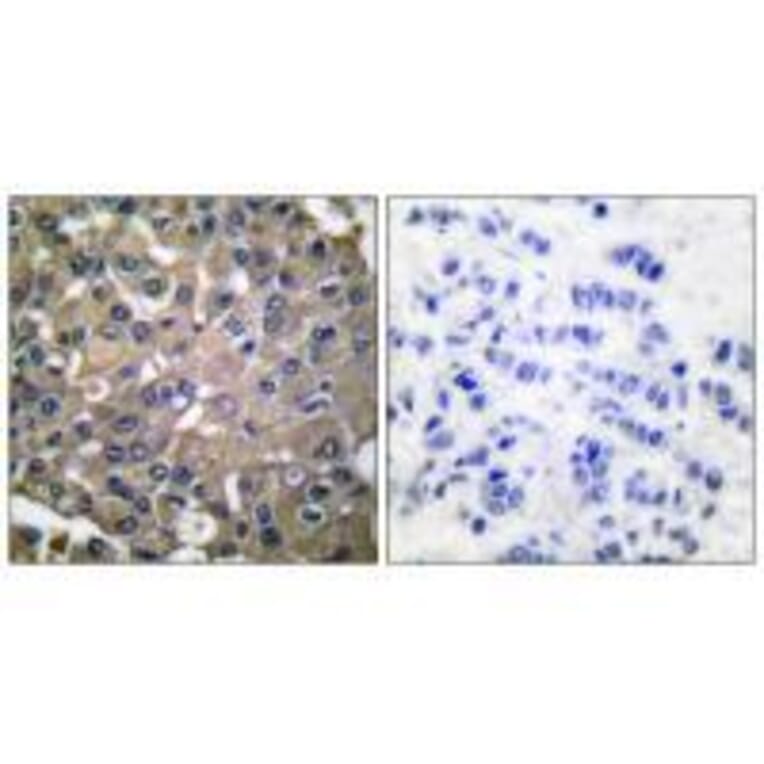 Immunohistochemistry - MMP-9 Antibody from Signalway Antibody (33446) - Antibodies.com