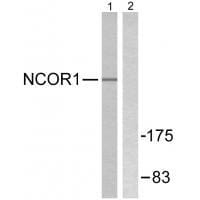 Western blot analysis of extracts from MDA-MB-435 cells, using NCoR1 antibody #33512.