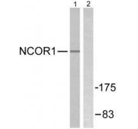 Western blot - NCoR1 Antibody from Signalway Antibody (33512) - Antibodies.com
