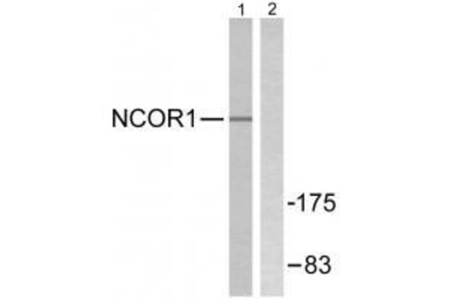 Western blot - NCoR1 Antibody from Signalway Antibody (33512) - Antibodies.com