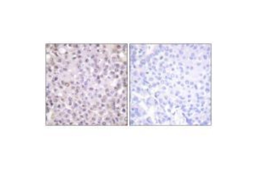 Immunohistochemistry - NCoR1 Antibody from Signalway Antibody (33512) - Antibodies.com