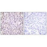 Immunohistochemistry - NCoR1 Antibody from Signalway Antibody (33512) - Antibodies.com