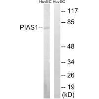 Western blot analysis of extracts from MDA-MB-435 cells, using PIAS1 antibody #33515.