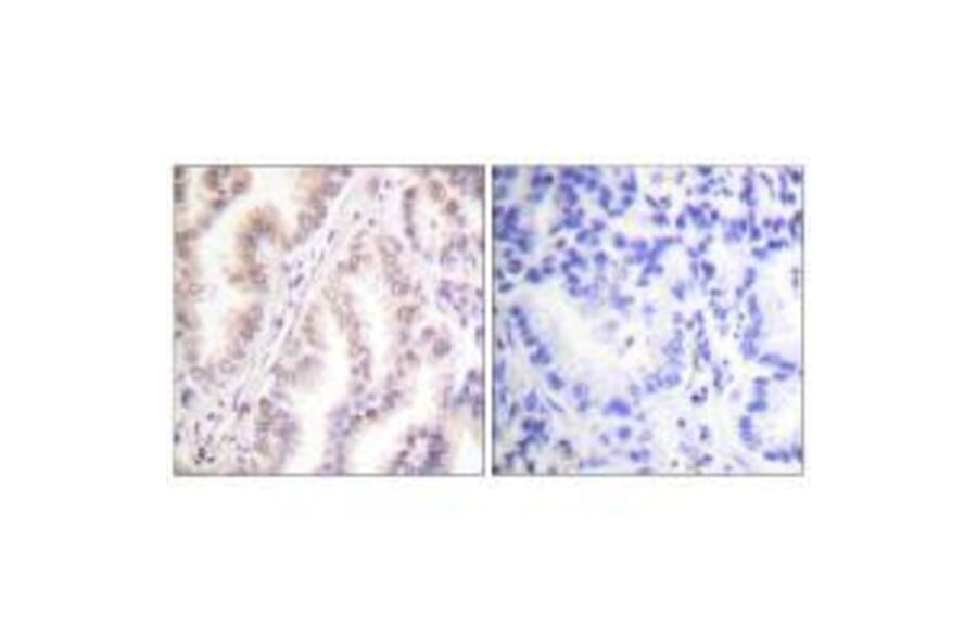 Immunohistochemistry - PIAS1 Antibody from Signalway Antibody (33515) - Antibodies.com
