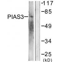 Western blot analysis of extracts from 293 cells, treated with UV (5mins), using PIAS3 antibody #33517.