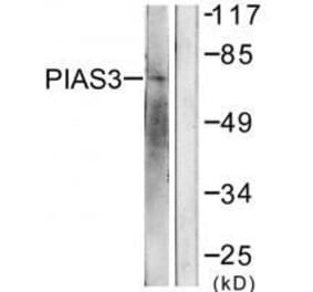 Western blot - PIAS3 Antibody from Signalway Antibody (33517) - Antibodies.com