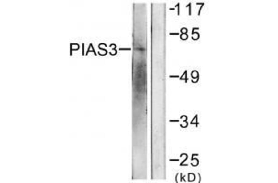 Western blot - PIAS3 Antibody from Signalway Antibody (33517) - Antibodies.com