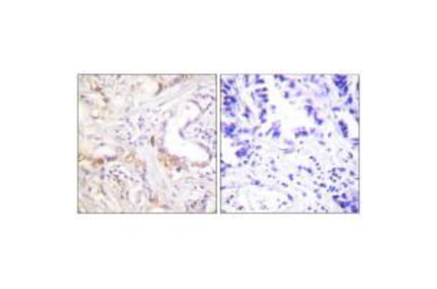 Immunohistochemistry - PIAS3 Antibody from Signalway Antibody (33517) - Antibodies.com
