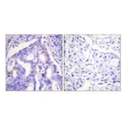 Immunohistochemistry - PIAS4 Antibody from Signalway Antibody (33518) - Antibodies.com