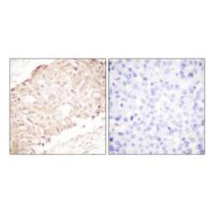 Immunohistochemistry - SENP1 Antibody from Signalway Antibody (33519) - Antibodies.com
