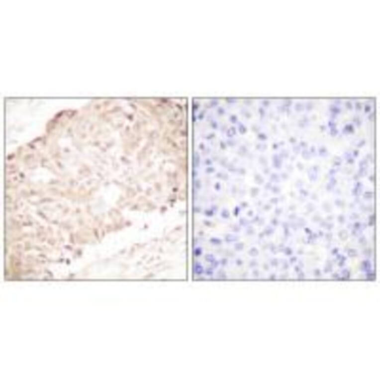 Immunohistochemistry - SENP1 Antibody from Signalway Antibody (33519) - Antibodies.com