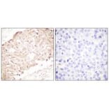 Immunohistochemistry - SENP1 Antibody from Signalway Antibody (33519) - Antibodies.com