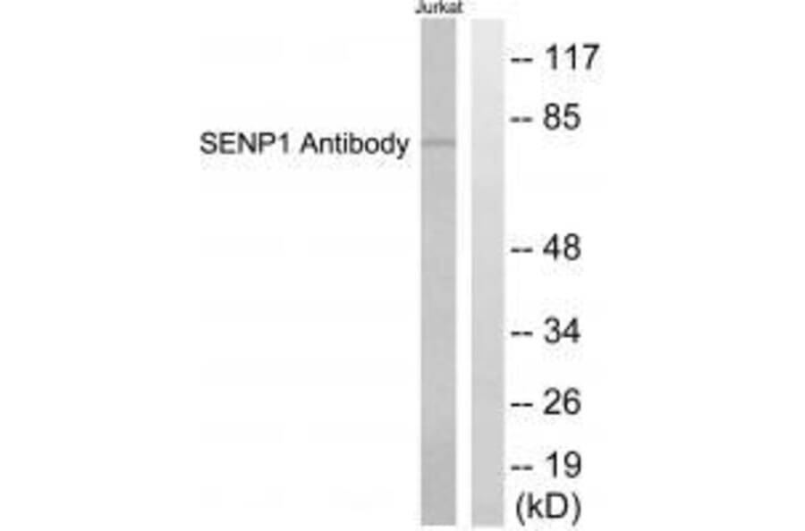 Western blot - SENP1 Antibody from Signalway Antibody (33519) - Antibodies.com