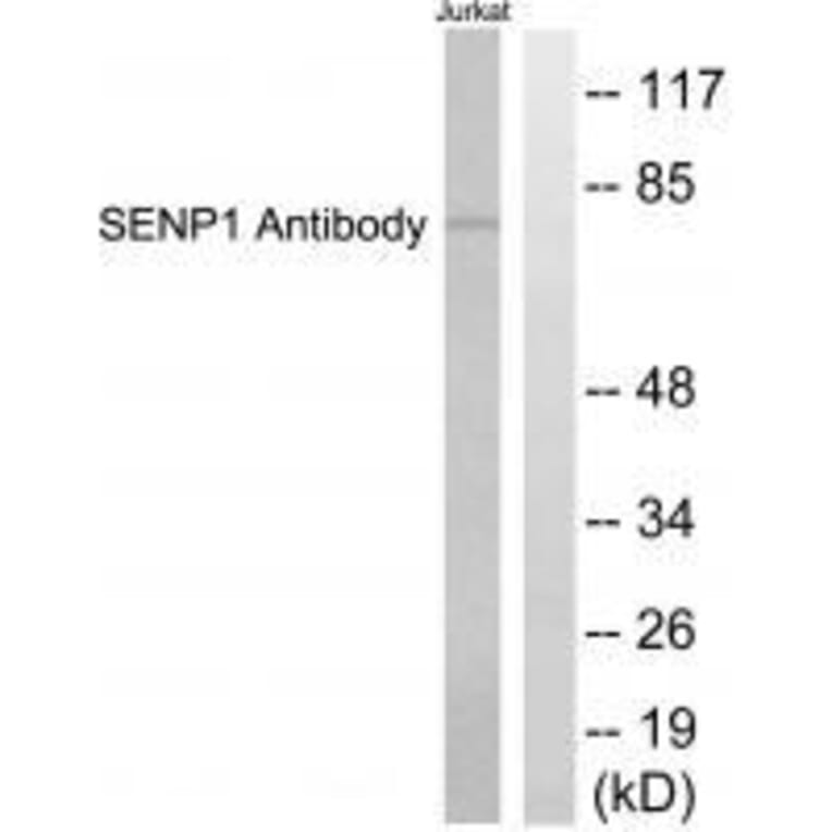 Western blot - SENP1 Antibody from Signalway Antibody (33519) - Antibodies.com