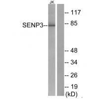 Western blot analysis of extracts from Jurkat cells, using SENP3 antibody #33520.