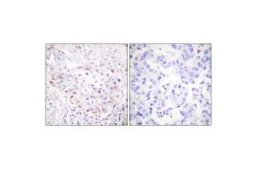 Immunohistochemistry - SENP3 Antibody from Signalway Antibody (33520) - Antibodies.com